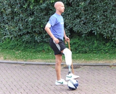 Ewings Sarcoma - Matt Short